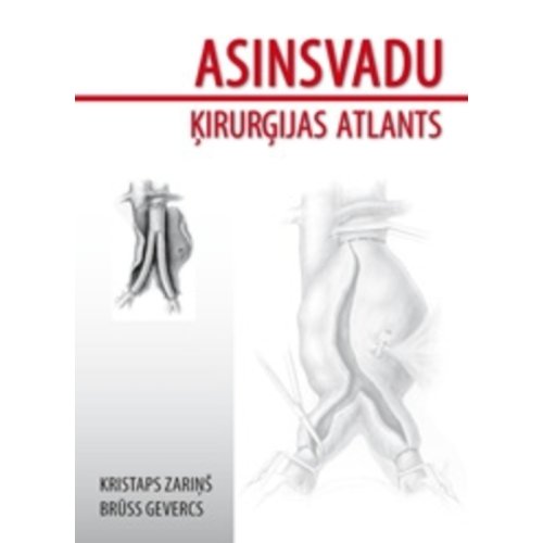 Asinvadu ķirurģijas atlants